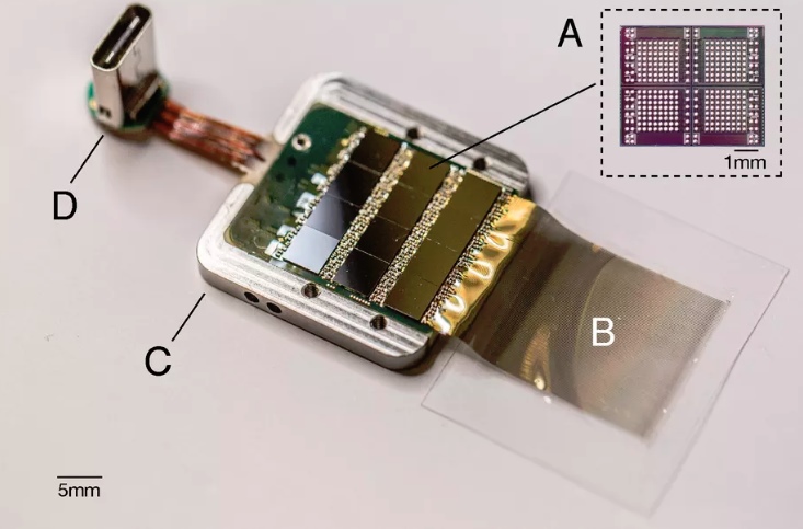 Neuralink implant