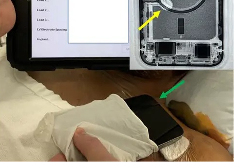 Studiu iPhone 12 poate fi periculos pentru persoanele care au