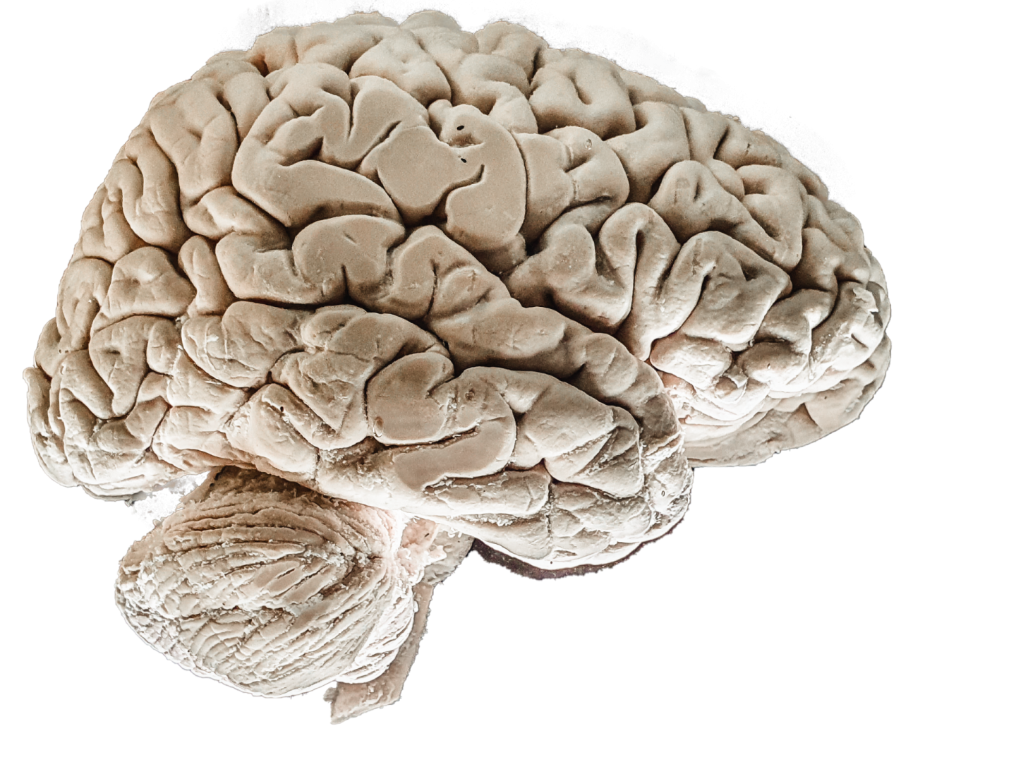 Implant neural, permite unui paralizat să scrie cu 90 de caractere pe minut doar imaginându-și că scrie