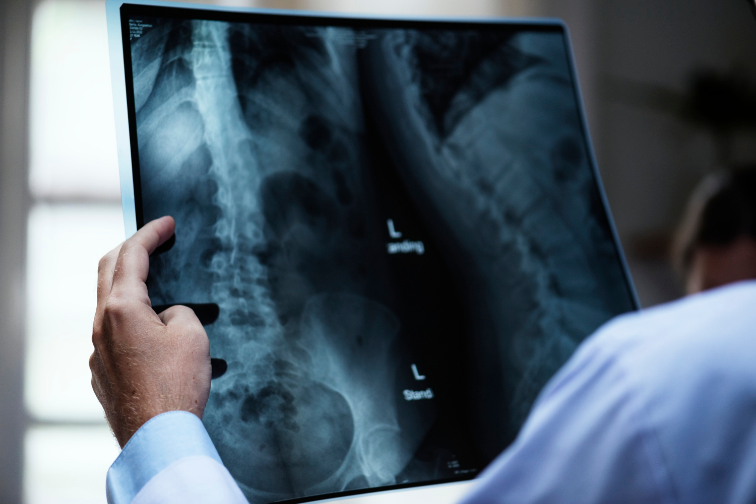 Un spital din România cumpără o soluție AI pentru interpretarea radiografiilor și CT-urilor