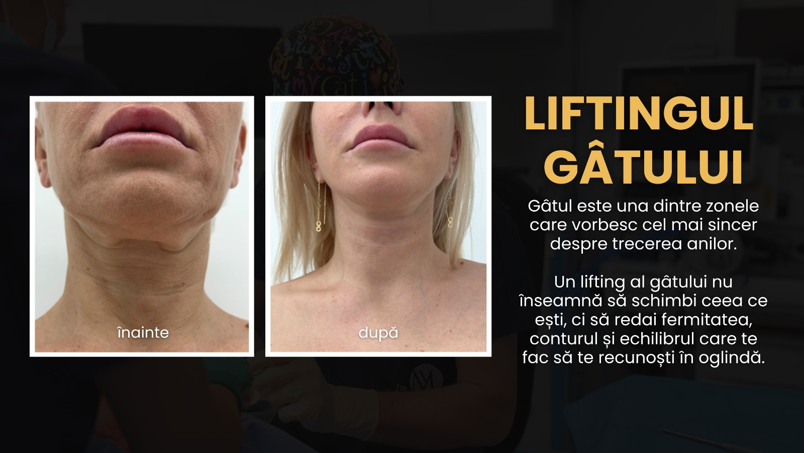 Liftingul de gât: de ce gâtul îmbătrânește primul și când devine operația estetică o opțiune (P)