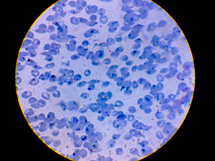 CellScope 